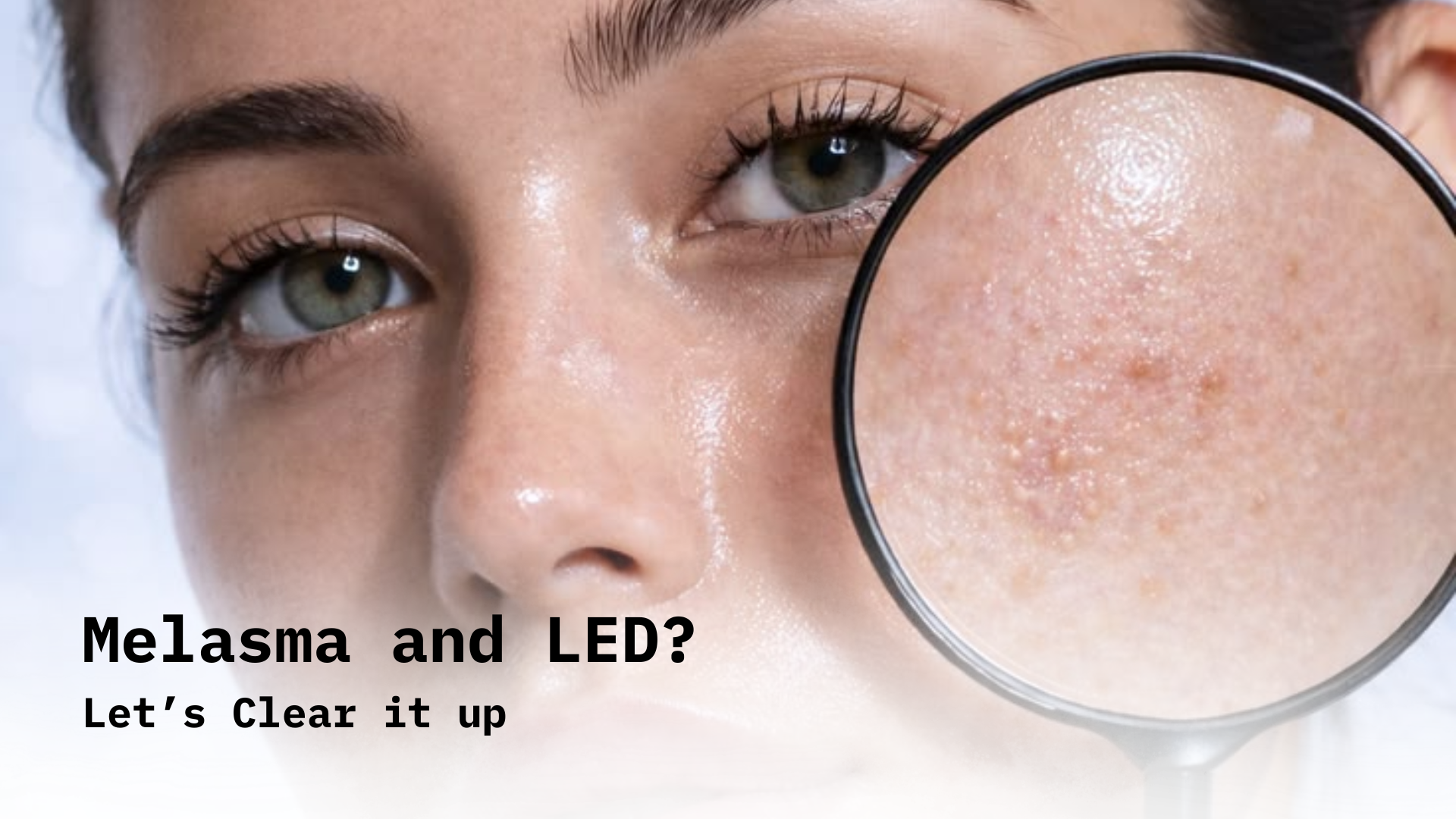 Can Your LED Mask Actually Trigger Melasma?